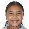 headshot of patient