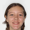 headshot of patient