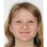 headshot of patient