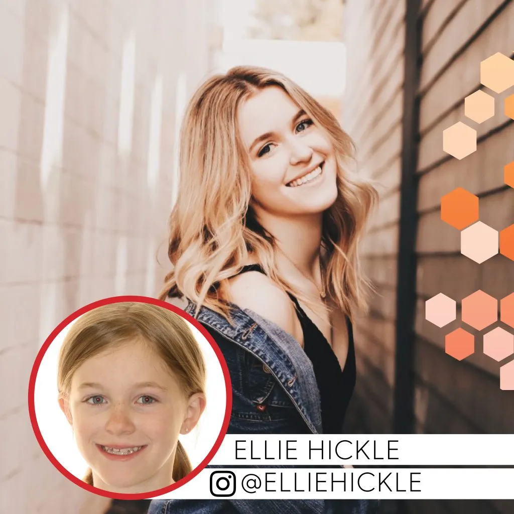 Ellie Hickle before and after treatment
