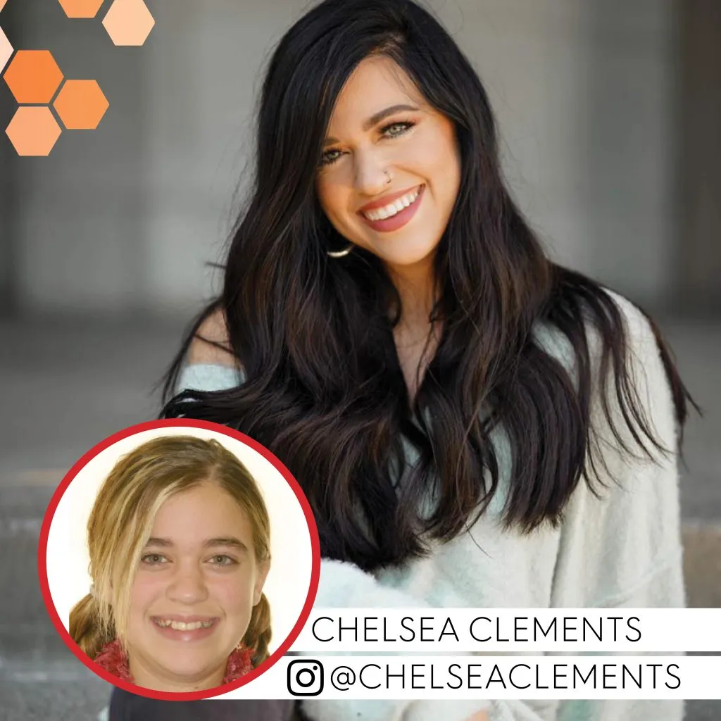 Chelsea Clements before and after treatment