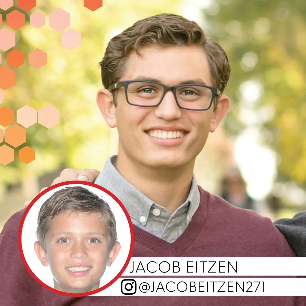 Jacob Eitzen before and after treatment