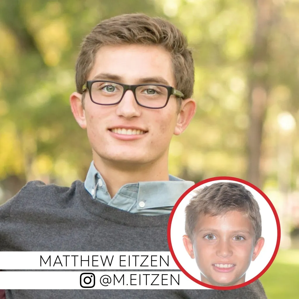 Matthew Eitzen before and after treatment