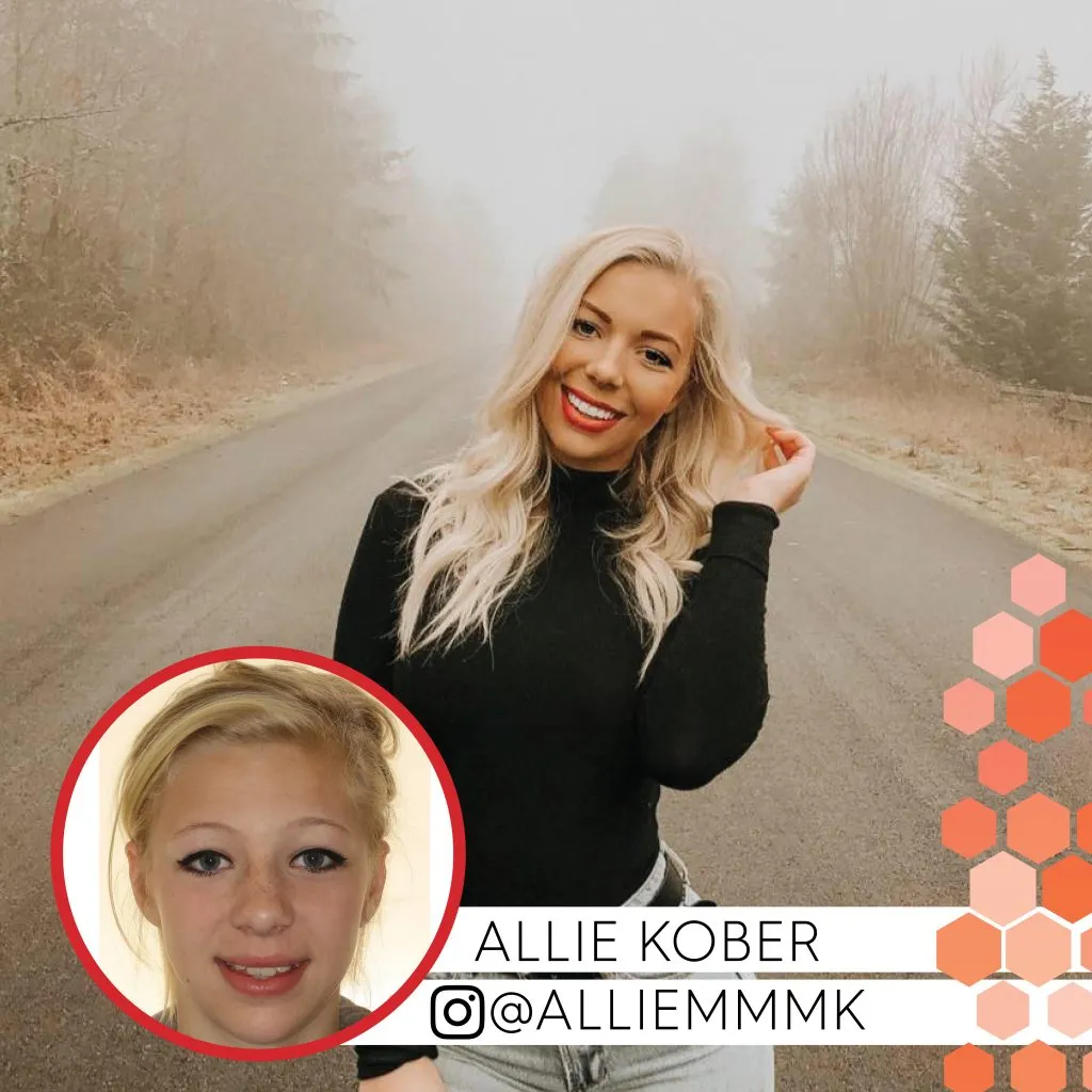 Allie Kober before and after treatment