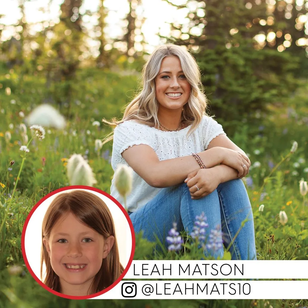 Leah Matson before and after treatment