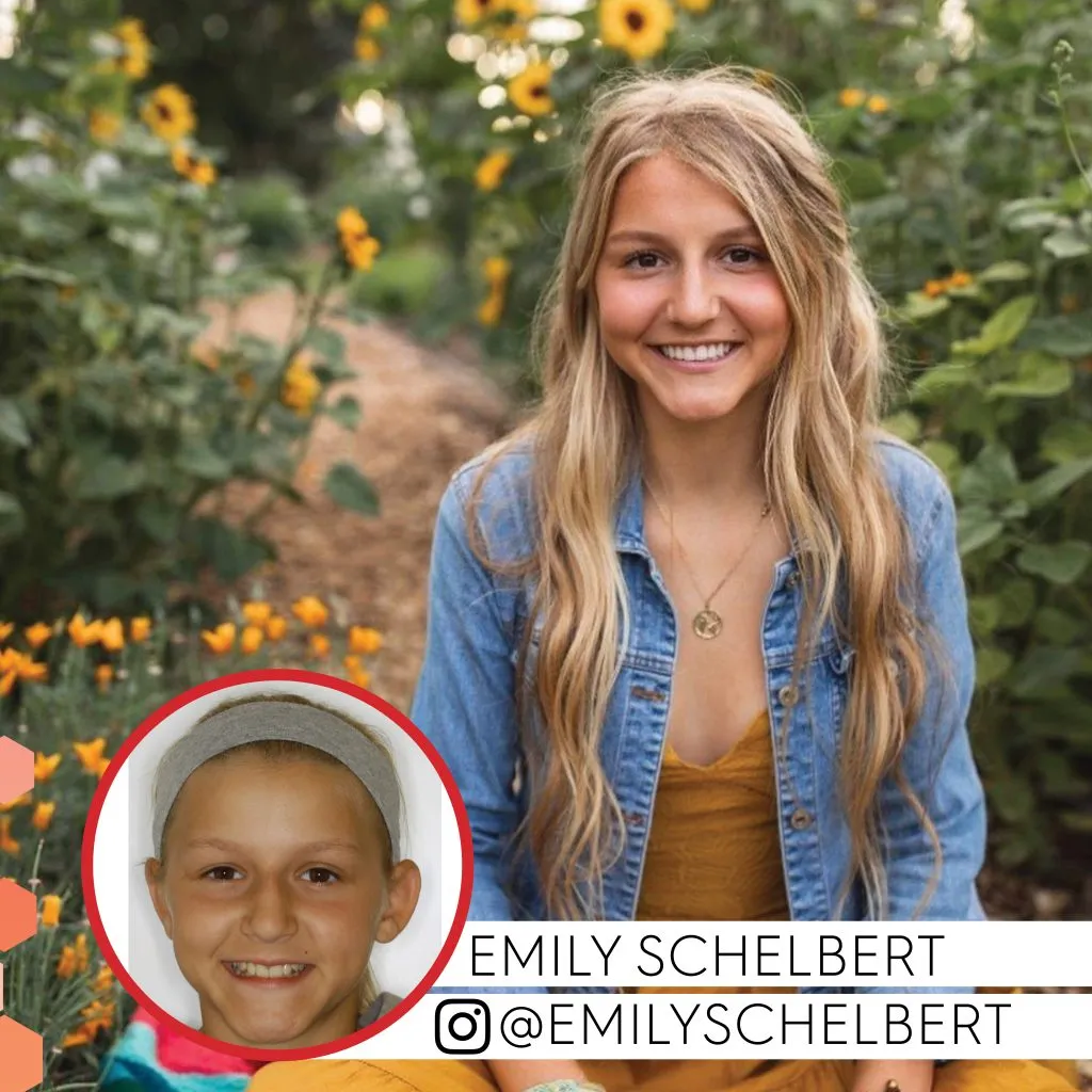 Emily Schelbert before and after treatment