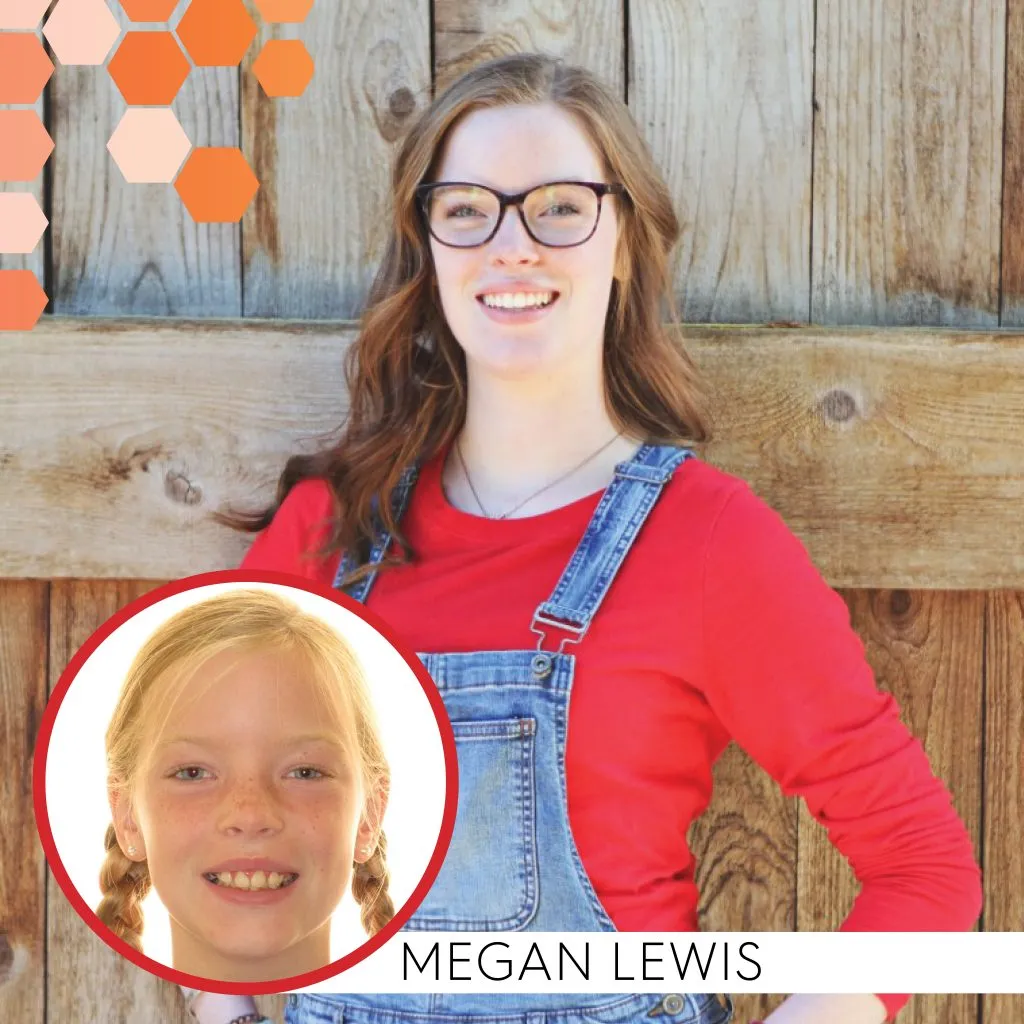 Megan Lewis before and after treatment