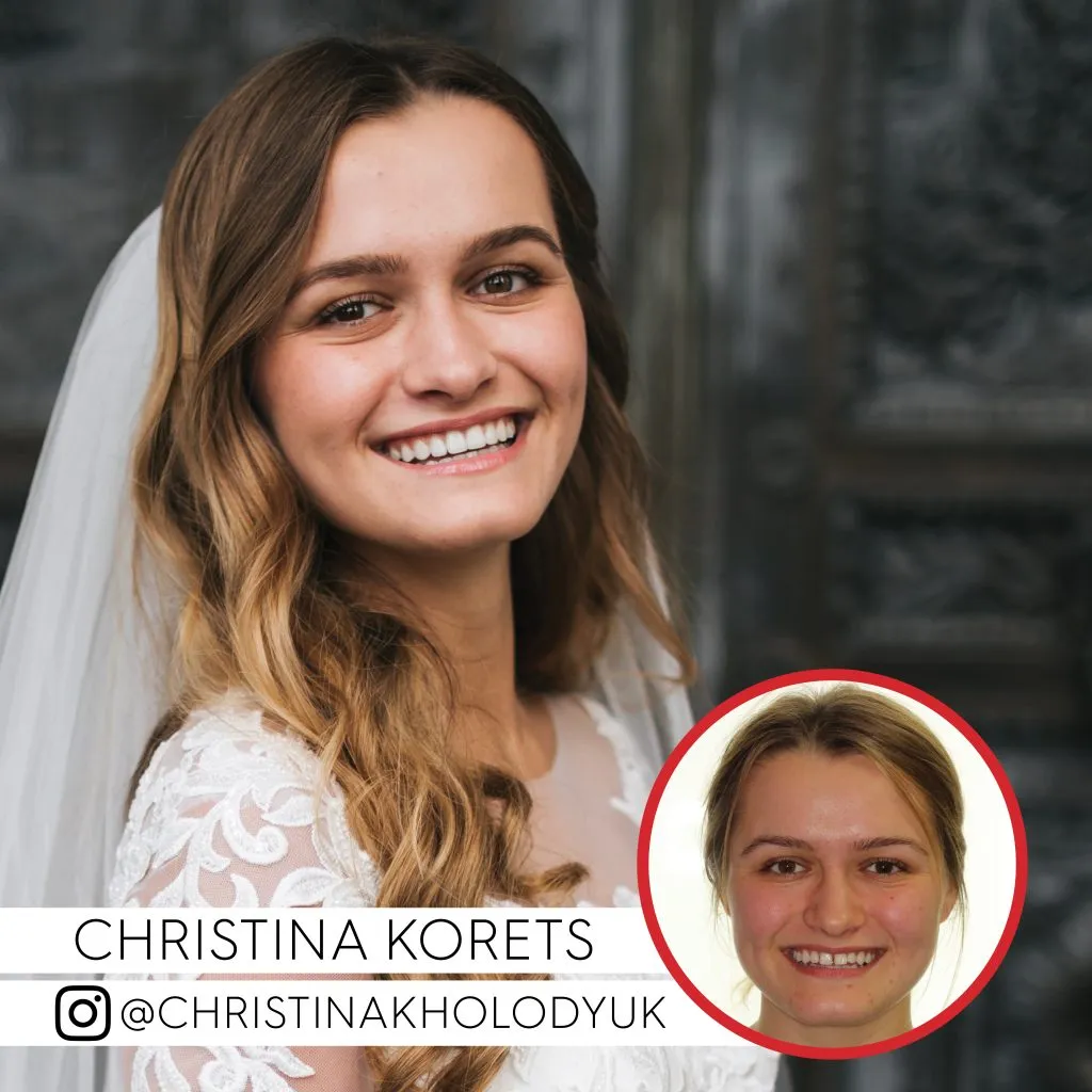 Christina Korets before and after