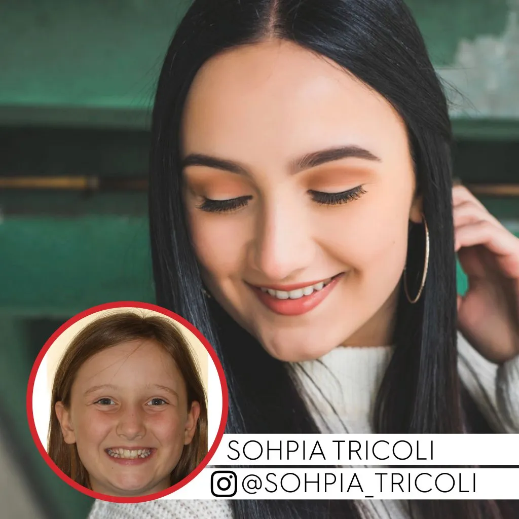 sohpia tricoli before and after treatment