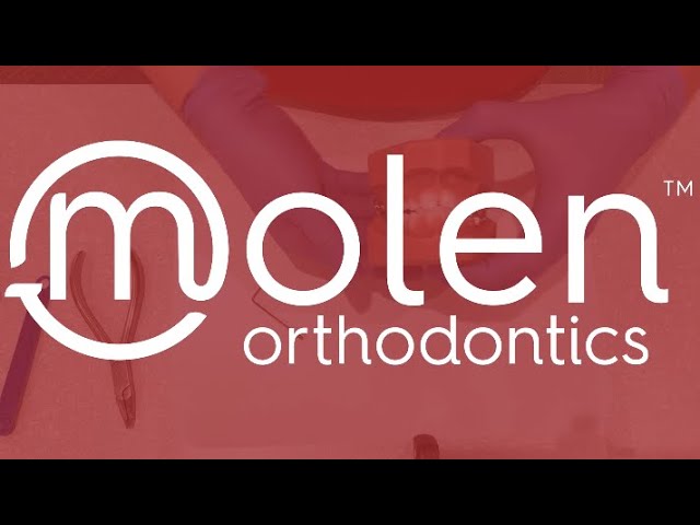 Molen Transformations