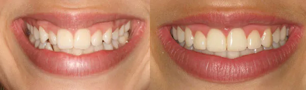 teen treated in 12 months