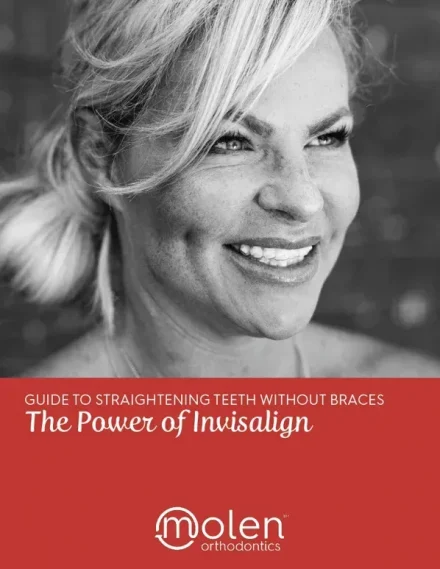 The power of invisalign guide